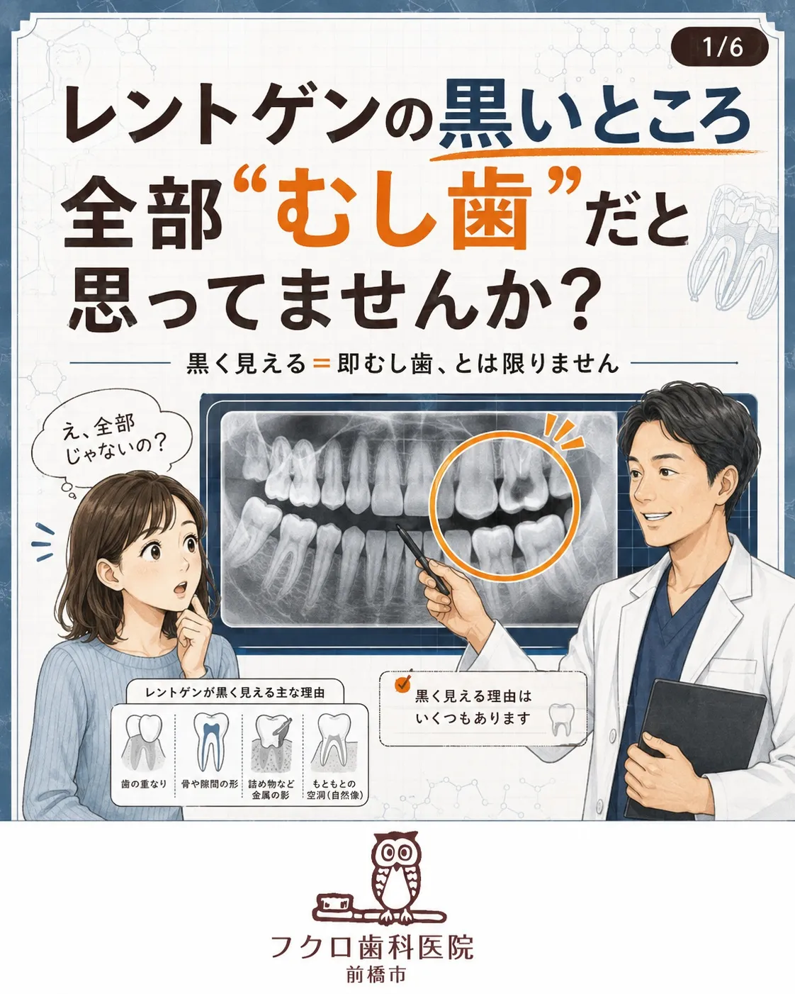 歯医者でレントゲンを見せてもらったとき、