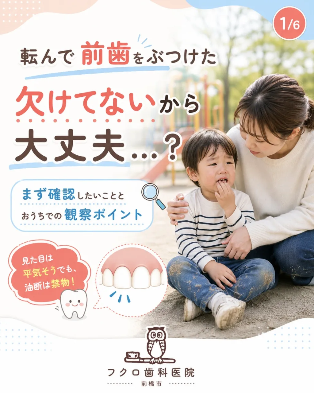 「転んで前歯をぶつけたけど、欠けてないから大丈夫かな?」