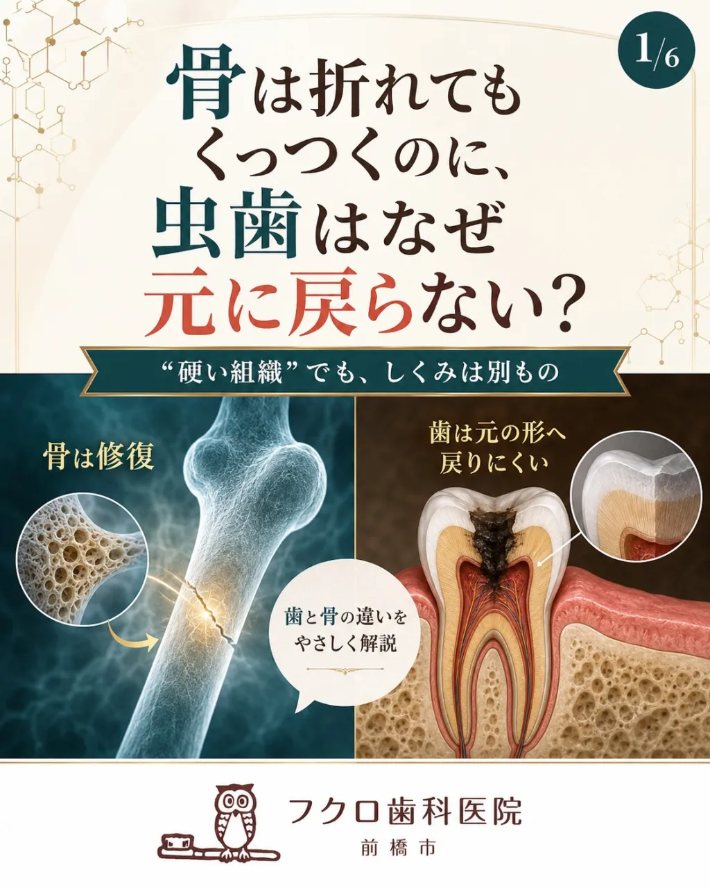 「骨は折れても治るのに、虫歯はなぜ元に戻らないの?」