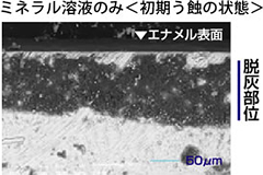 手術前の口内（横側）