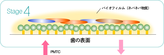 ステージ4