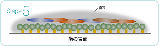 ステージ5