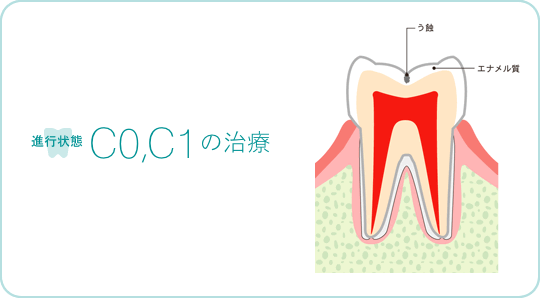 進行状態C0,C1